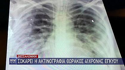 Σοκάρει η ακτινογραφία θώρακος 41χρονης - Της πήραν το παιδί στους 5,5 μήνες της κύησης