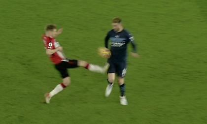 Η τρομακτική πληγή στο πόδι του Λαπόρτ από την «σκαριά» του Άρμστρονγκ (pic)