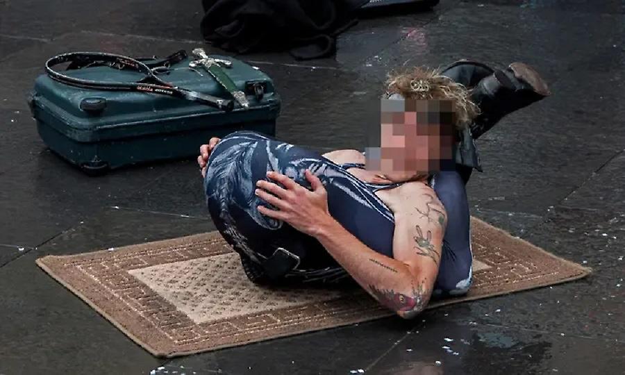 Άνδρας έμεινε με χρόνιο πρόβλημα στη μέση αφού προσπάθησε να κάνει στοματικό έρωτα στον εαυτό του