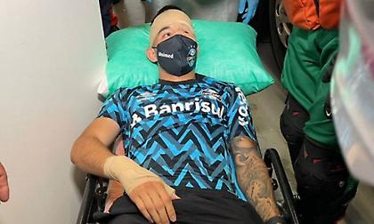 Τραγικές εικόνες στην Βραζιλία: Οπαδοί τραυμάτισαν παίκτη της Γκρέμιο με πέτρα στο κεφάλι