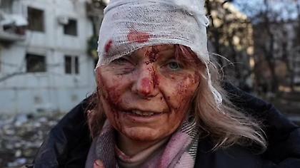 Η Ουκρανή-θύμα της ρωσικής βαρβαρότητας σπάει τη σιωπή της: Πώς κατάφερα να ξεφύγω από τον πόλεμο