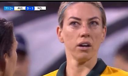 Γυναίκα ποδοσφαιριστής είδε στο μόνιτορ πως έσπασε η μύτη της και… γέλαγε!