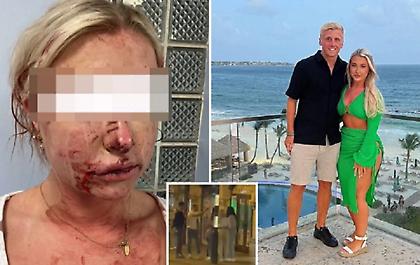 Ξυλοφόρτωσαν σύντροφο ποδοσφαιριστή της Ντέρμπι - Σοκάρει η εικόνα της μετά την επίθεση