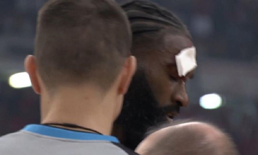 Μάτωσε στο μέτωπο και πήγε στα αποδυτήρια ο Σαντ Ρος