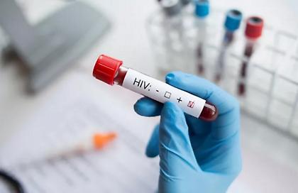 Άνδρας 66 ετών στις ΗΠΑ, ο τέταρτος ασθενής που θεραπεύεται από τον HIV