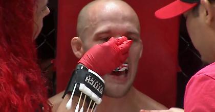 Σοκαριστικό κάταγμα μύτης μαχητή του ΜΜΑ μετά από γονατιά