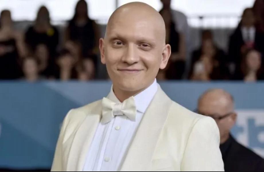 Άντονι Κάριγκαν: Η αλωπεκία με έκανε καλύτερο ηθοποιό