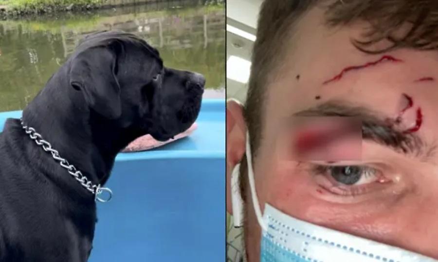Έσωσε σκύλο βγάζοντάς τον από λίμνη αλλά... κατέληξε με δαγκωματιά στο πρόσωπο