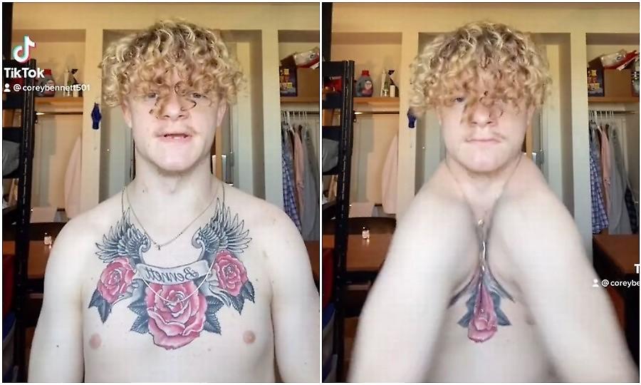 Άντρας που γεννήθηκε χωρίς κλείδα κάνει τους ώμους του να ακουμπούν μεταξύ τους