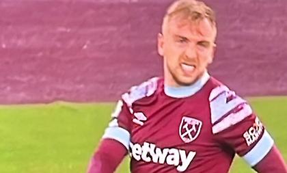 Εικόνα-σοκ με το εξαρθρωμένο δάχτυλο του Μπόουεν