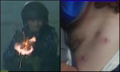 Η αστυνομία στο Χιμνάσια-Μπόκα τραυμάτισε τον κόσμο με πλαστικές σφαίρες