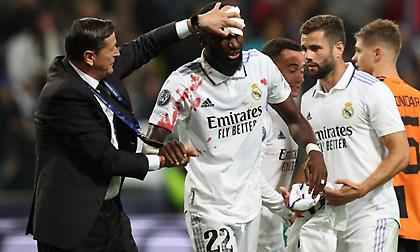 Ρούντιγκερ για τη σφοδρή σύγκρουση: «Ό,τι δε σε σκοτώνει, σε κάνει πιο δυνατό»