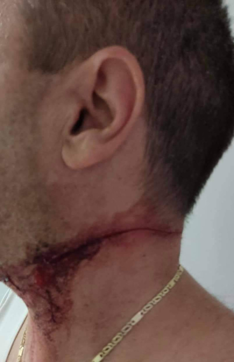 Θεσσαλονίκη: Δίωξη σε 45χρονο που επιτέθηκε σε αστυνομικούς