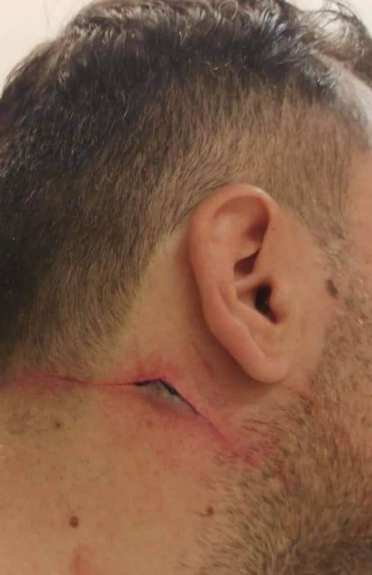 Θεσσαλονίκη: Δίωξη σε 45χρονο που επιτέθηκε σε αστυνομικούς