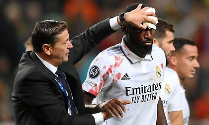 Με προστατευτική μάσκα στο «Clasico» ο Ρίντιγκερ