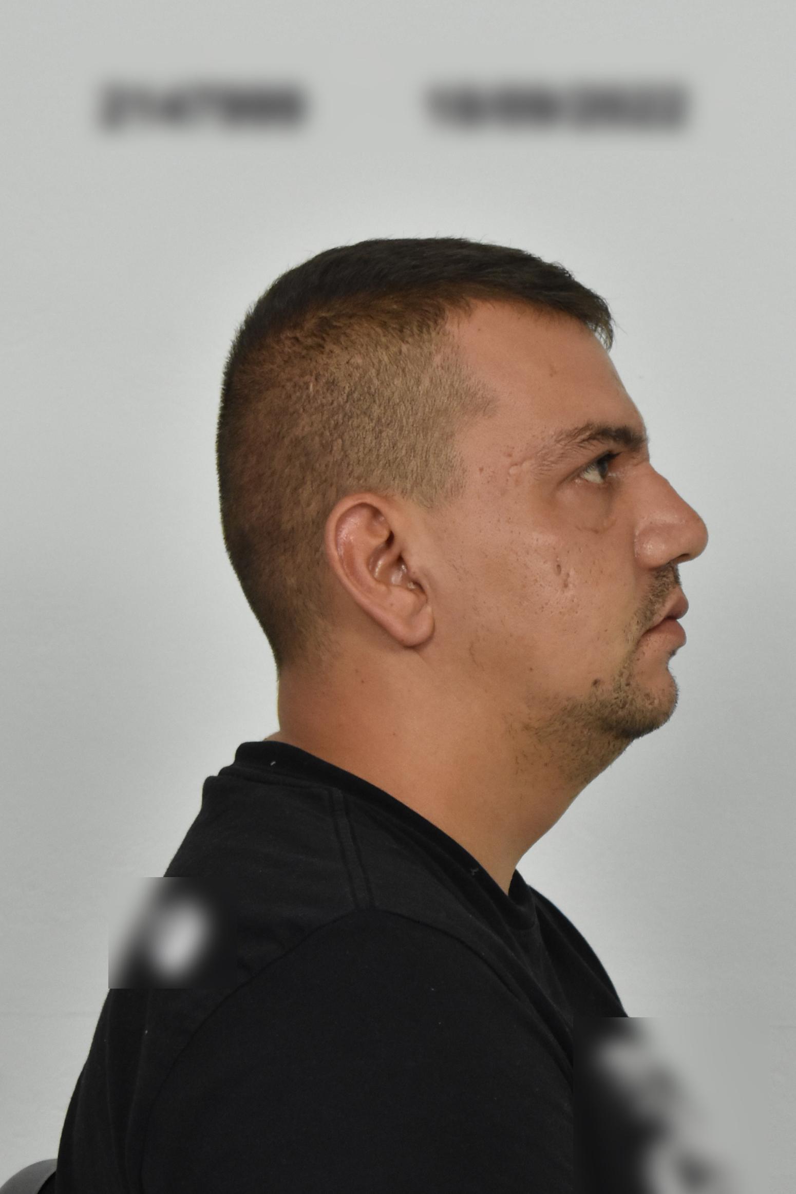 Νίκαια: Αυτός είναι ο 28χρονος που προσπάθησε να βιάσει