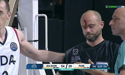 Ντιζόν-ΠΑΟΚ: Η μπάλα χτύπησε τον καμεραμάν στο κεφάλι και αυτός μάτωσε!