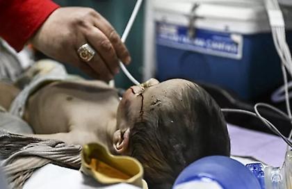 Τουρκία: Σώθηκε 7 μηνών αγοράκι μετά από 140 ώρες