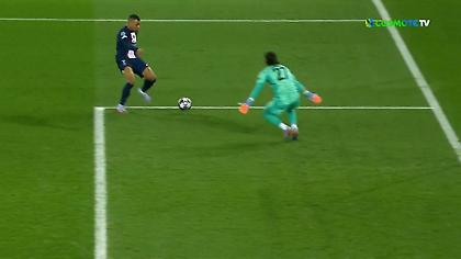 Επέμβαση με το... πρόσωπο από τον Ζόμερ!