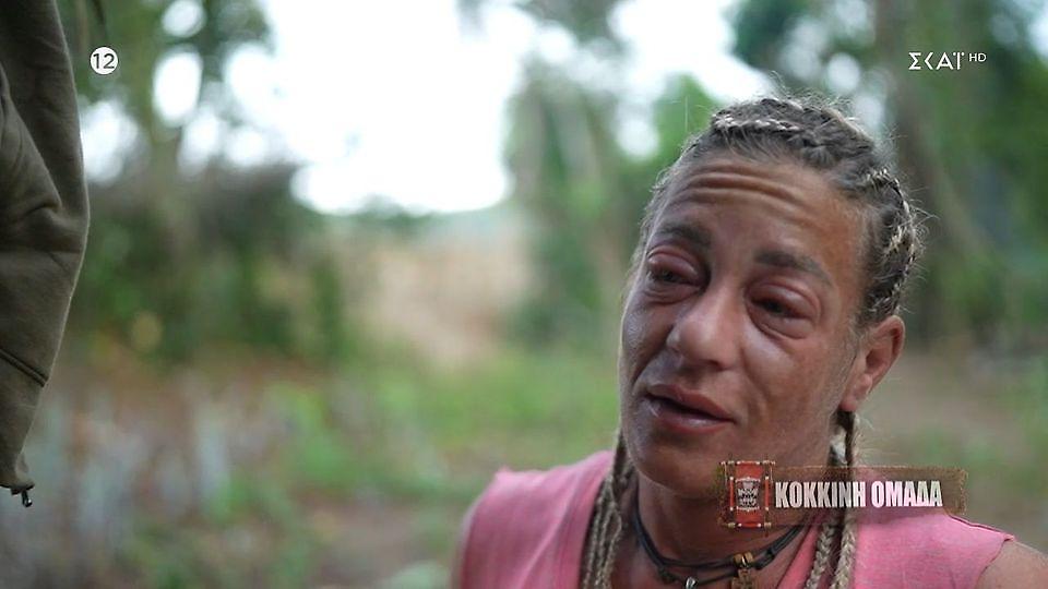 Survivor: Παραμορφώθηκε η Αφροδίτη - «Αλλεργική αντίδραση»