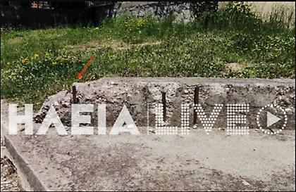 Στο νοσoκομείο της Πάτρας 5χρονη με κάταγμα κρανίου, μετά από ατύχημα σε παιδική χαρά