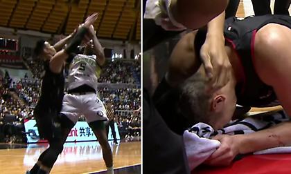 Χτύπησε άσχημα στο κεφάλι και έπαθε διάσειση ο Τζέρεμι Λιν!