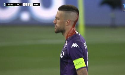 Προσωρινή διακοπή στον τελικό του Conference, μάτωσε από ρίψη αντικειμένου ο Μπιράγκι!