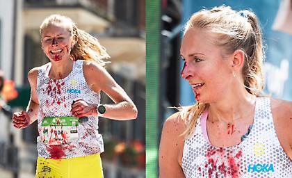 Συγκλονιστική: Δρομέας χτύπησε, δεν τα παράτησε και με ματωμένο χαμόγελο ολοκλήρωσε μαραθώνιο!