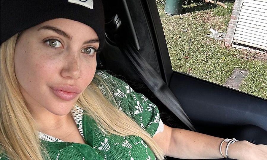 Η Γουάντα Νάρα επιβεβαίωσε πως πάσχει από λευχαιμία