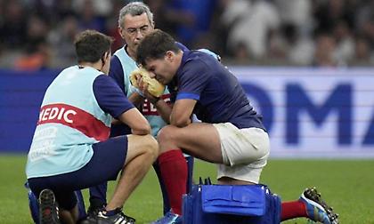 Σοκαριστικός τραυματισμός Γάλλου στο ράγκμπι - Υπέστη κάταγμα στο ζυγωματικό