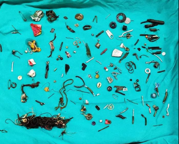 Άνδρας στο νοσοκομείο με πόνους στο στομάχι