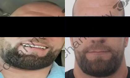 Αλβανικά ΜΜΕ: Αυτοί είναι οι δύο δράστες της επίθεσης στο Γκάζι