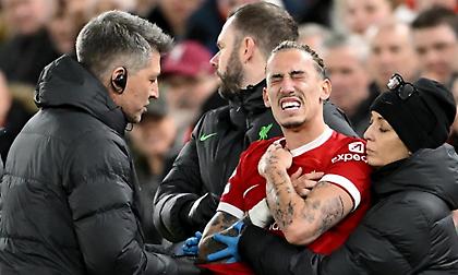 Επιβεβαίωσε για Τσιμίκα ο Κλοπ: «Έσπασε σίγουρα την κλείδα, θα έδινα τη δική μου για να είναι καλά» - Απολογήθηκε ο Σάκα