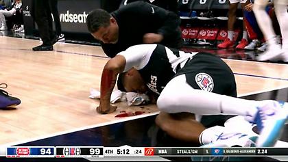 Σοκαριστικός τραυματισμός για τον Νόρμαν Πάουελ των Κλίπερς έπειτα από αγκωνιά του Ντουρέν