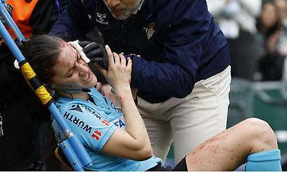 Σοβαρός τραυματισμός διαιτητή από τηλεοπτική κάμερα στο Μπέτις-Αθλέτικ!