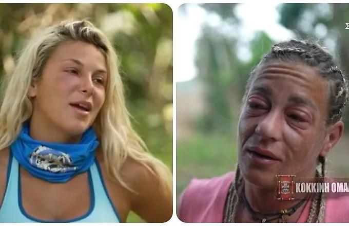 Survivor 2024: Πρήστηκε το πρόσωπο της Χρύσας - Θύμισε Αφροδίτη!