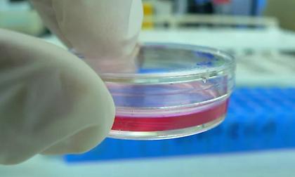 Βρετανία: Εργαλείο τεχνητής νοημοσύνης ανίχνευσε καρκίνο που διέφυγε των γιατρών