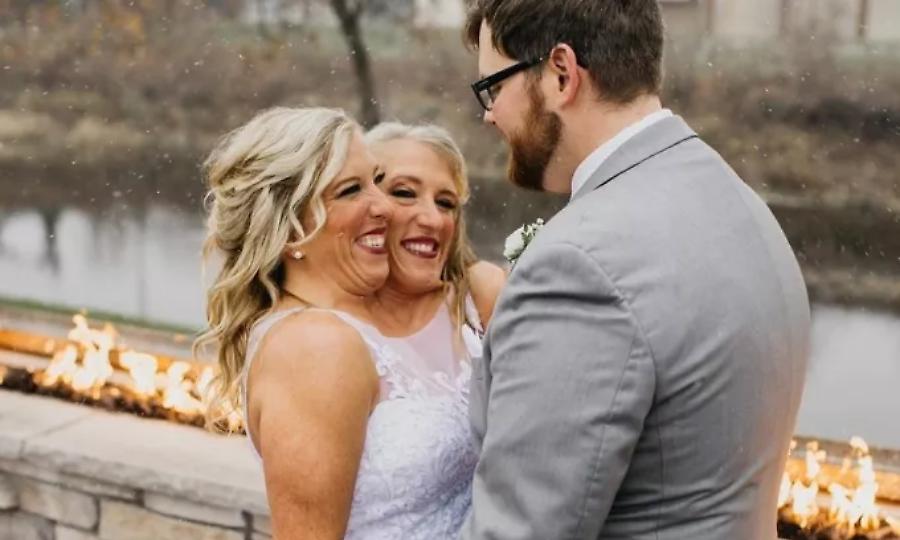 Άνδρας παντρεύτηκε σιαμαία και τη δίδυμη αδερφή της - Δηλώνουν έτοιμες να κάνουν παιδί!