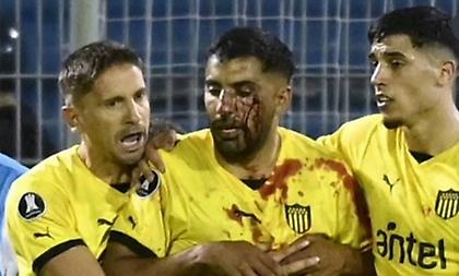 Παίκτης της Πενιαρόλ δέχτηκε πέτρα στο πρόσωπο από τους οπαδούς της Ροζάριο Σέντραλ