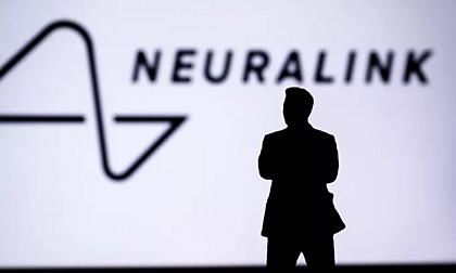 Η Neuralink του Ίλον Μασκ παραδέχθηκε δυσλειτουργία στο εμφύτευμα εγκεφάλου που τοποθέτησε σε ασθενή
