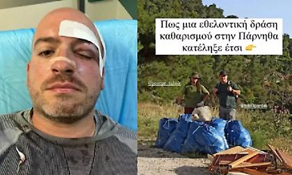 Άγρια επίθεση στην Πάρνηθα: Ξυλοκόπησαν και μαχαίρωσαν εθελοντές που καθάριζαν την περιοχή - Δείτε φωτογραφίες