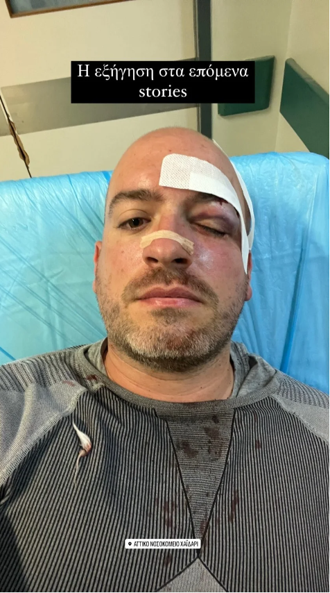 Άγρια επίθεση στην Πάρνηθα: Ξυλοκόπησαν και μαχαίρωσαν εθελοντές που καθάριζαν την περιοχή