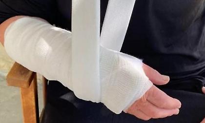 Αγρίνιο: Επιχείρησαν να κλέψουν τσάντα από ηλικιωμένη - Δεν τα κατάφεραν, αλλά της έσπασαν το χέρι