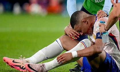 Βάζει μάσκα και συνεχίζει στο Euro ο Εμπαπέ μετά το κάταγμα μύτης