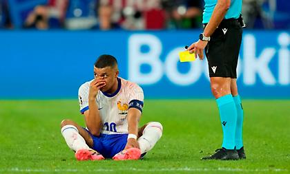 Ντεσάν: «Ο Εμπαπέ μάλλον έχει σπάσει τη μύτη του»