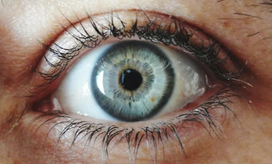Αλλαγή στην πρώτη θέση της λίστας για το πιο σπάνιο χρώμα ματιών - Το έχει λιγότερο το 1% του παγκοσμίου πληθυσμού