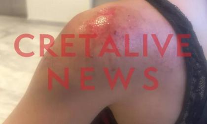 Εφιαλτικές στιγμές για 25χρονη στο Ηράκλειο: Την φωτογράφισε κρυφά, την χτύπησε με μηχανάκι και την έσυρε για 20 μέτρα