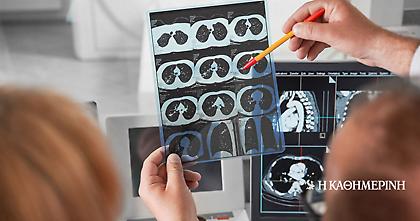 Χρειάζεται εθνικό σχέδιο για τον καρκίνο