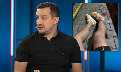 Σοκ στην Τουρκία: Πυροβόλησαν παλαίμαχο της Φενέρμπαχτσε μετά από εκπομπή για την πρεμιέρα του Europa League!