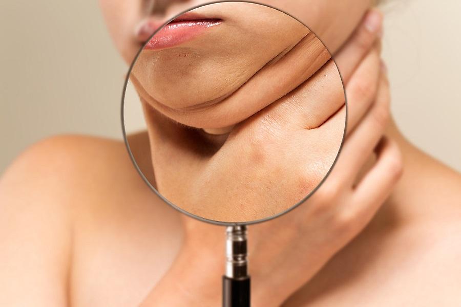 Πώς να απαλλαγείς από το προγούλι